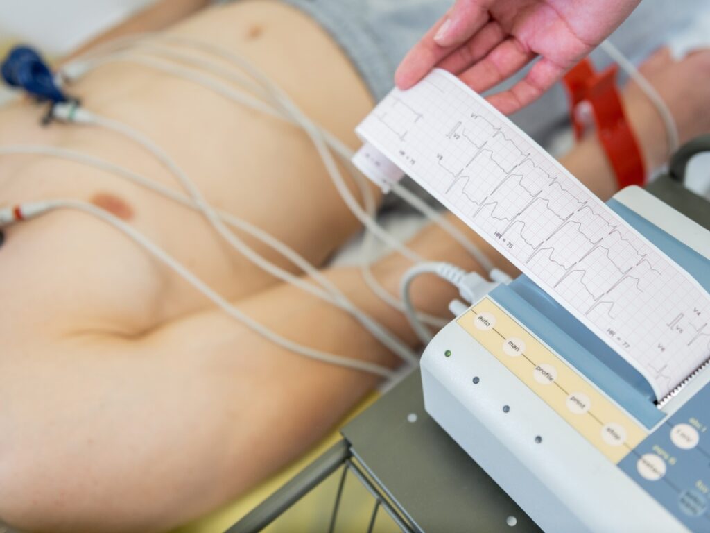 EKG srca poliklinika gusić